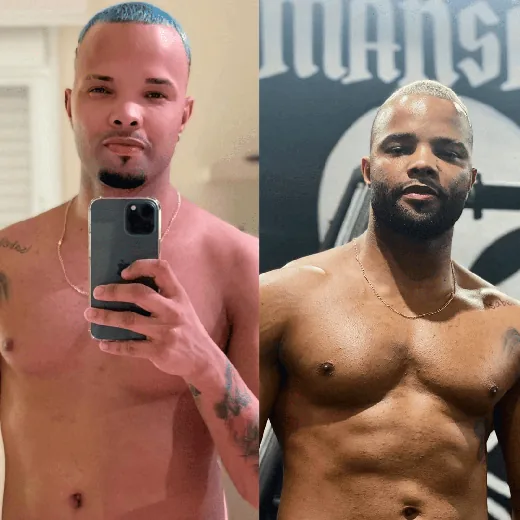 Antes e depois de MC Zaac