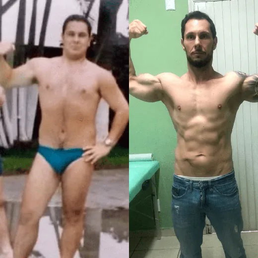 Antes e depois de Paciente da clínica
