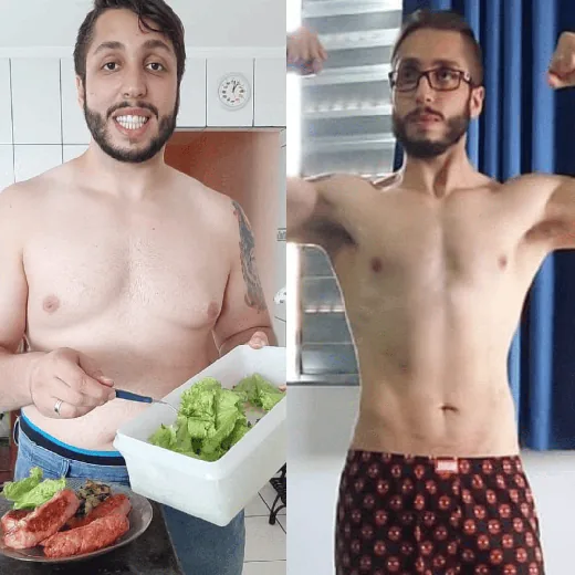 Antes e depois de Paciente da clínica