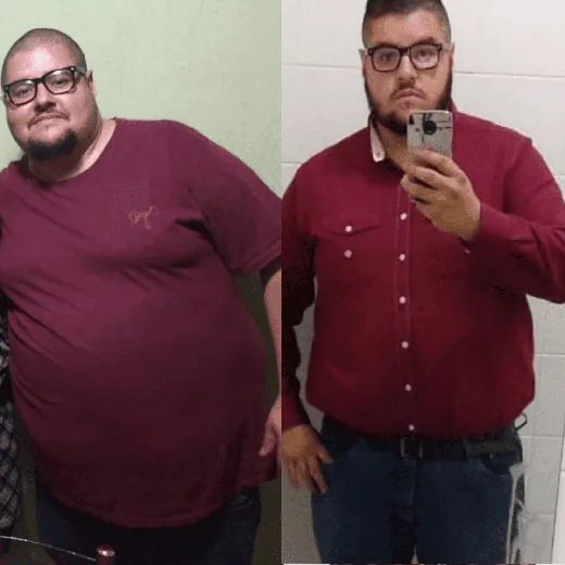 Antes e depois de Paciente da clínica