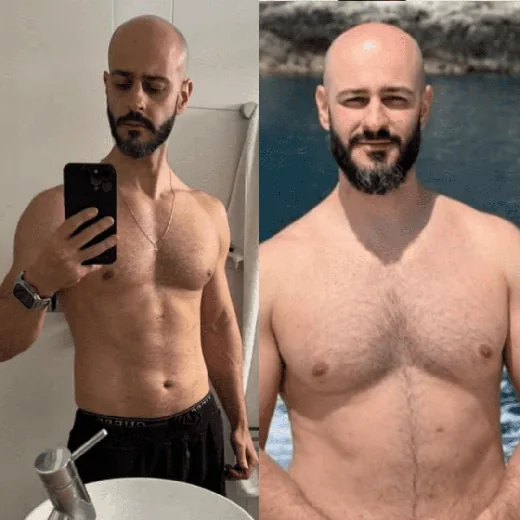 Antes e depois de Paciente da clínica