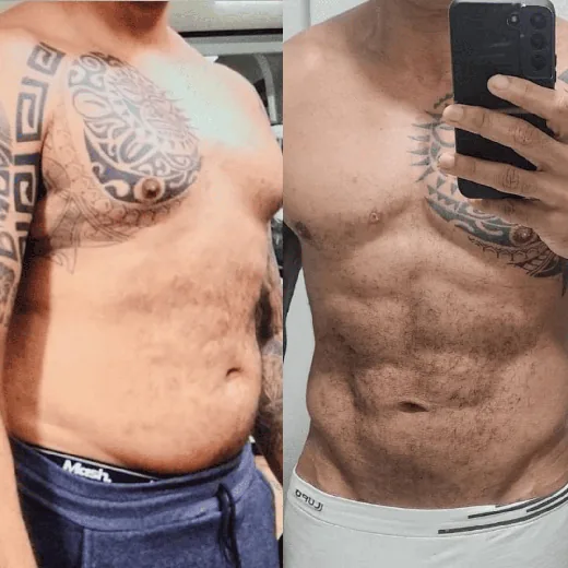 Antes e depois de Paciente da clínica