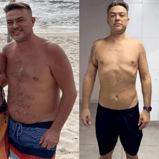Antes e depois de Paciente da clínica