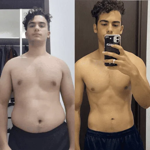 Antes e depois de Paciente da clínica