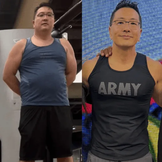 Antes e depois de Paciente da clínica