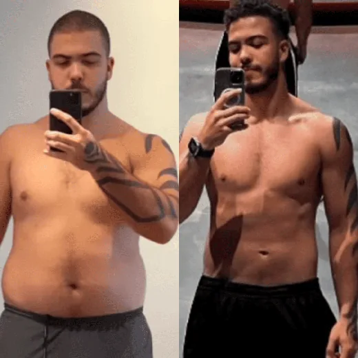 Antes e depois de Ronald