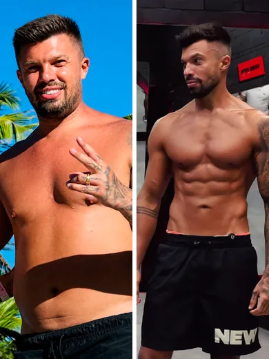 Antes e depois de Serginho