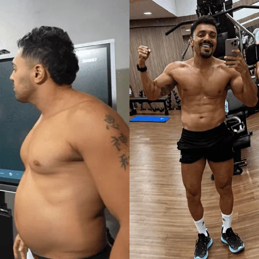 Antes e depois de Tirulipa